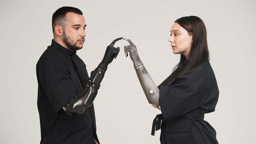 Протез-роборука Esper Hand украинского стартапа признан одним из лучших изобретений 2022 года и попал на обложку Time