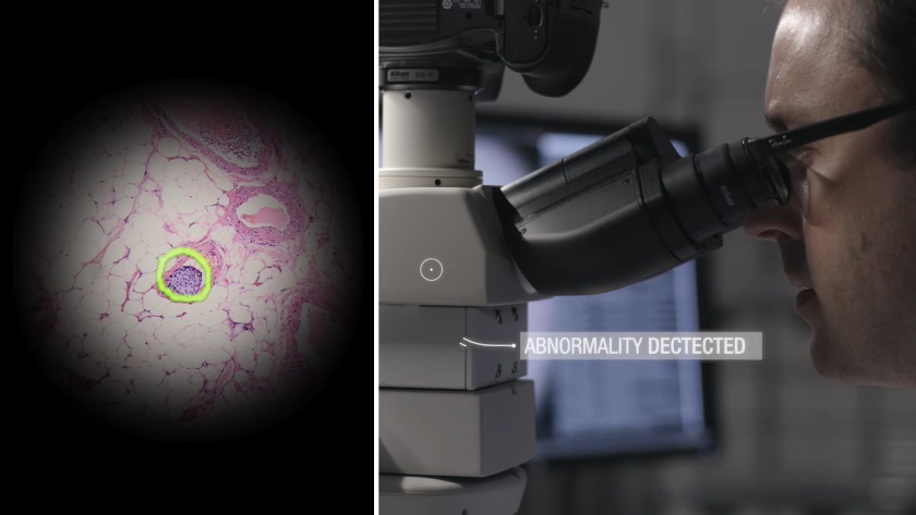 Inteligentny mikroskop Google pomaga diagnozować raka