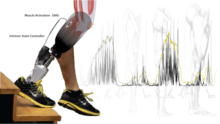 Интересное видео: "умные" протезы способны заменить отсутствующие конечности уже сейчас