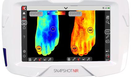 Draagbaar diagnostisch apparaat "Snapshot NIR" ter vervanging van echografie en röntgenstraling