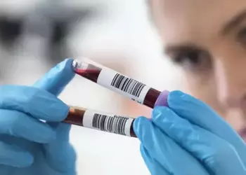 Китайские ученые создали ИИ-анализ крови, который диагностирует болезни за 15 лет до появления симптомов