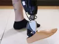 post_big/implanted-myoelectric-sensor-limb.jpg