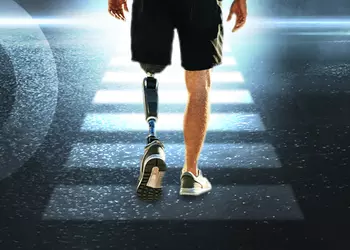 АЛЛО: 3D-лаборатория напечатала 195 элементов протезирования для 104 пациентов Superhumans Center