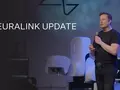 post_big2/neuralink-update-musk-01.webp