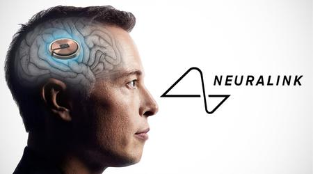Ni un solo mono muerto: Musk afirma que los implantes cerebrales Neuralink son seguros