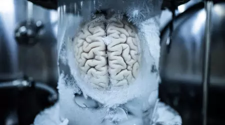 Кріоніка для початківців: як заморозити мозок і не перетворити його на кашу