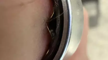 Батарея Galaxy Ring здулася прямо на пальці, розумне кільце довелося знімати в лікарні