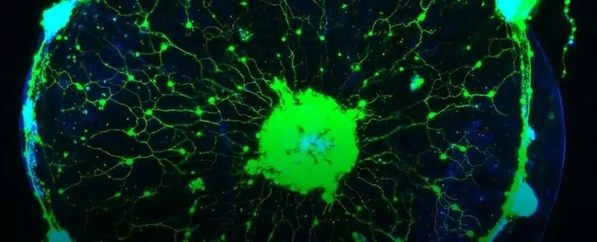 Ученые обнаружили способ читать мысли медуз