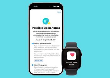 L'Apple Watch détecte désormais l'apnée du ...