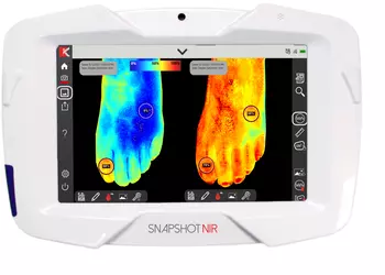 Портативное устройство для диагностики "Snapshot NIR" заменит ультразвук и рентген