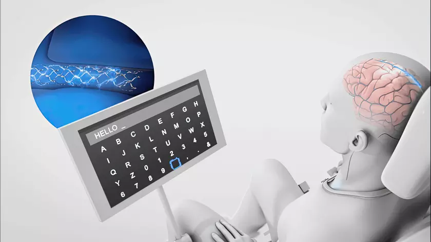 Компания Synchron интегрировала ChatGPT в свои мозговые импланты