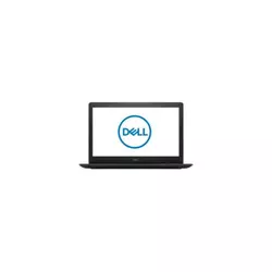 Dell Inspiron 3579 Black (35G3i78S2G15i-LBK)