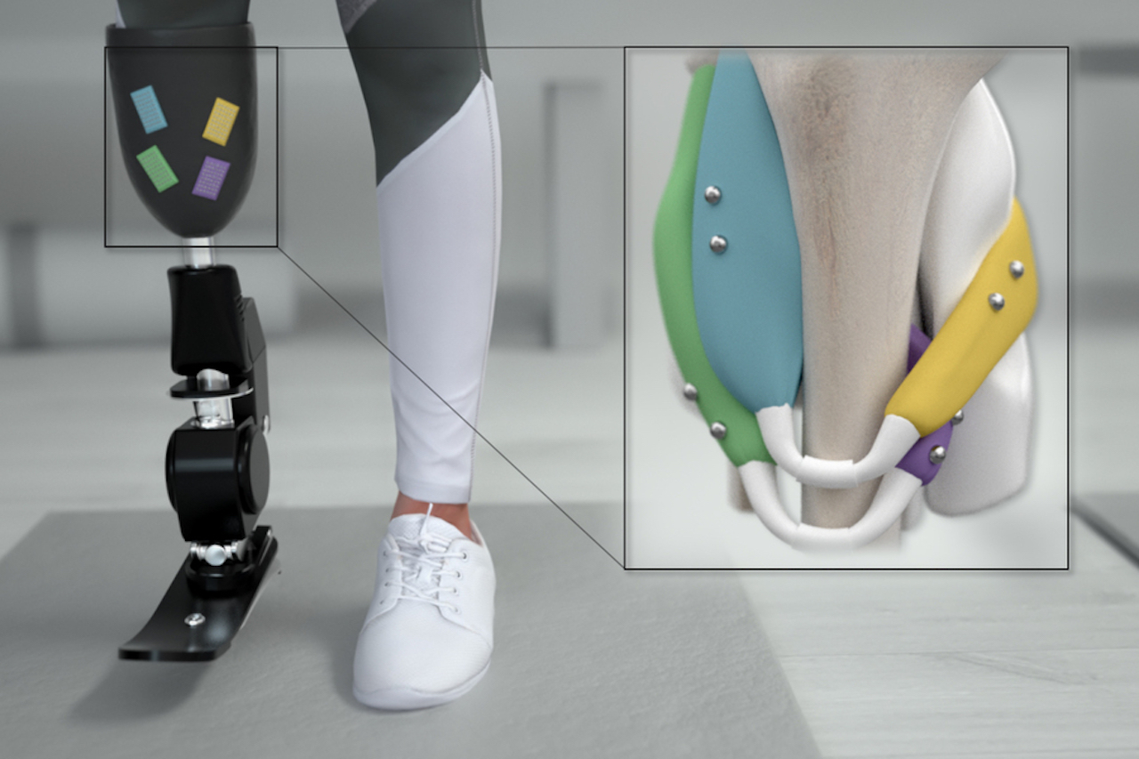 MIT: magnetic beads will help improve bionic prosthesis control [video]