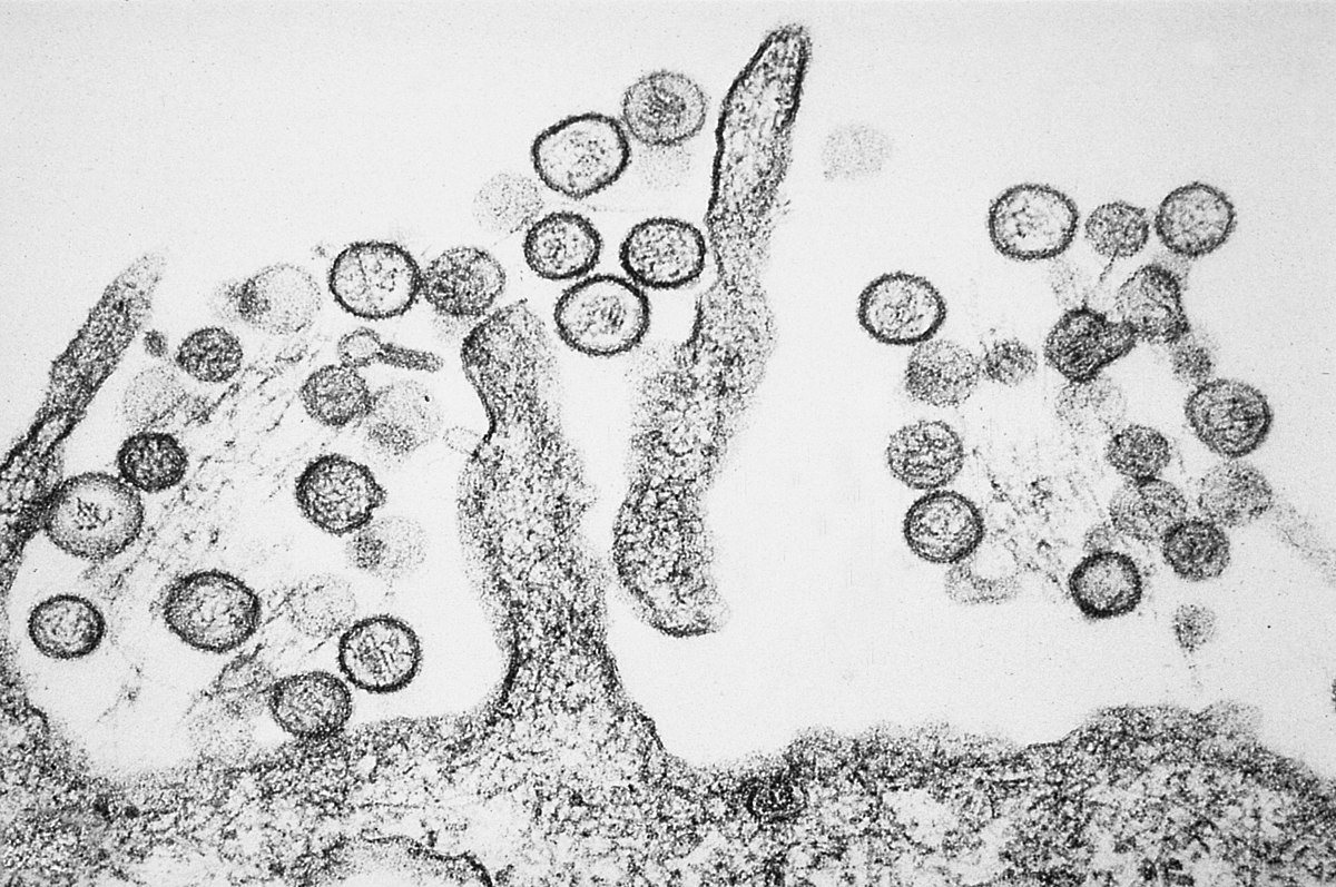 Un regard à l'intérieur : une micrographie unique de l'hantavirus