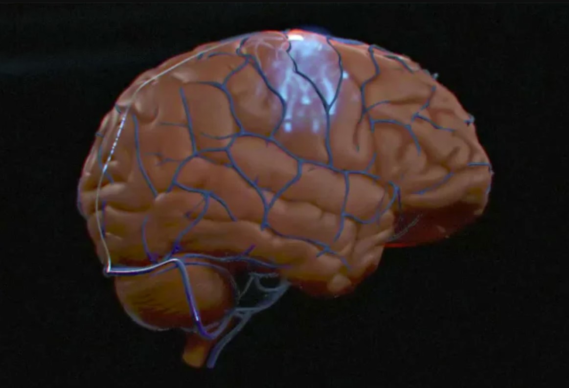 Synchron es la primera en implantar una interfaz cerebro-ordenador en Estados Unidos