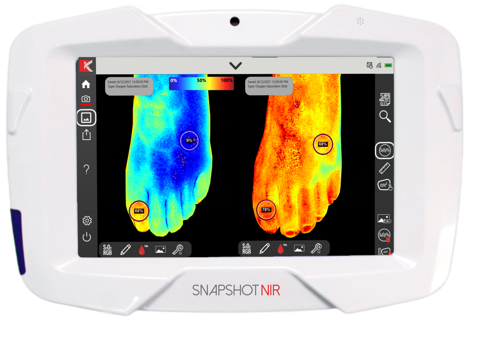 Portable diagnostic device "Snapshot NIR" to replace ultrasound and X-ray