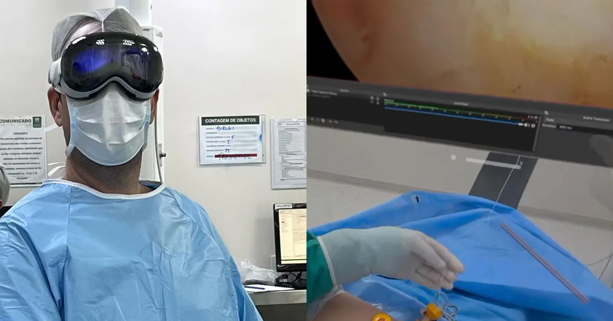 Apple Vision Pro hjelper leger i Brasil: Innovativt hodesett brukes under skulderartroskopi