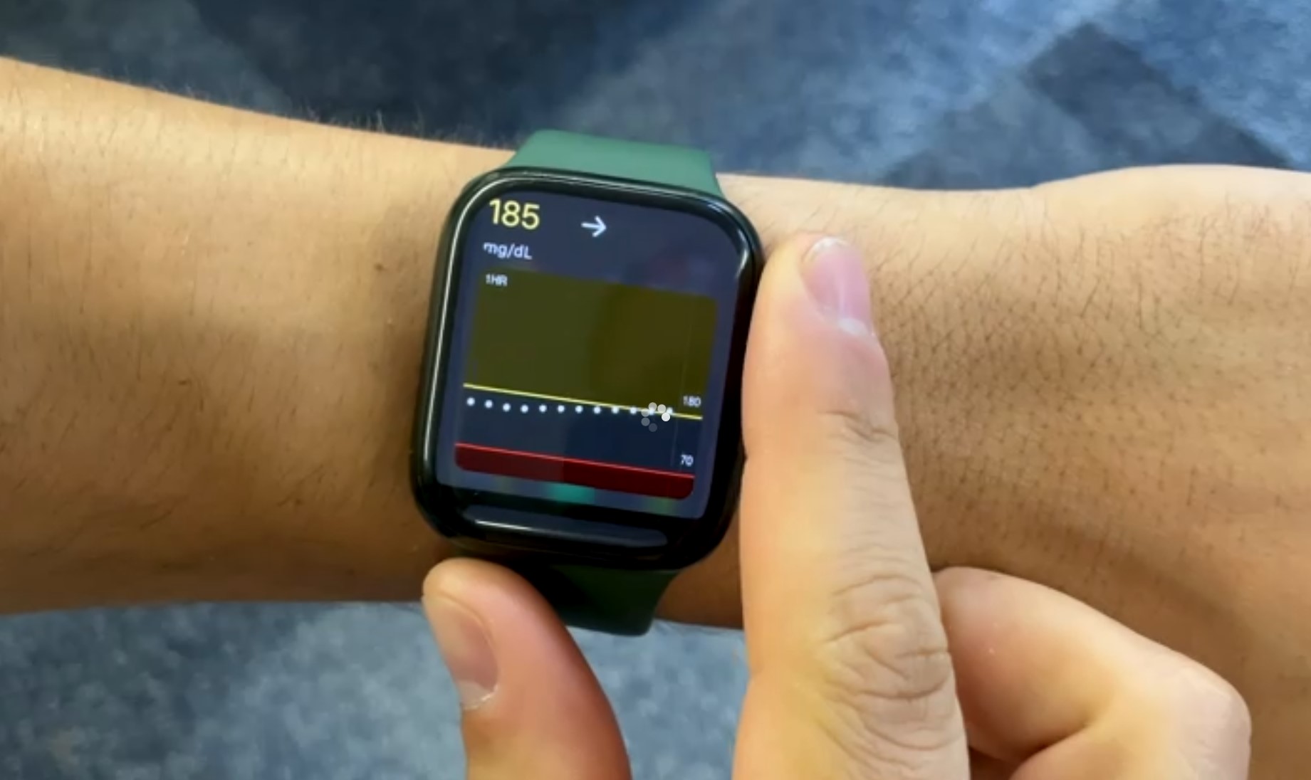 El videógrafo de CNET y diabético Justin Eastzer dice que el Apple Watch le salvó la vida