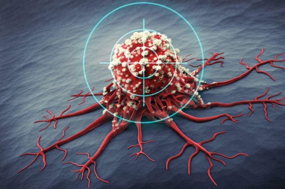 A new method of fighting cancer: direct delivery of chemotherapy directly into tumours