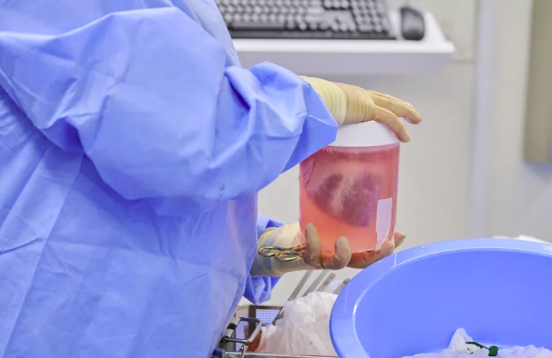 Forscher haben gentechnisch veränderte Schweineherzen in die Körper von Verstorbenen transplantiert