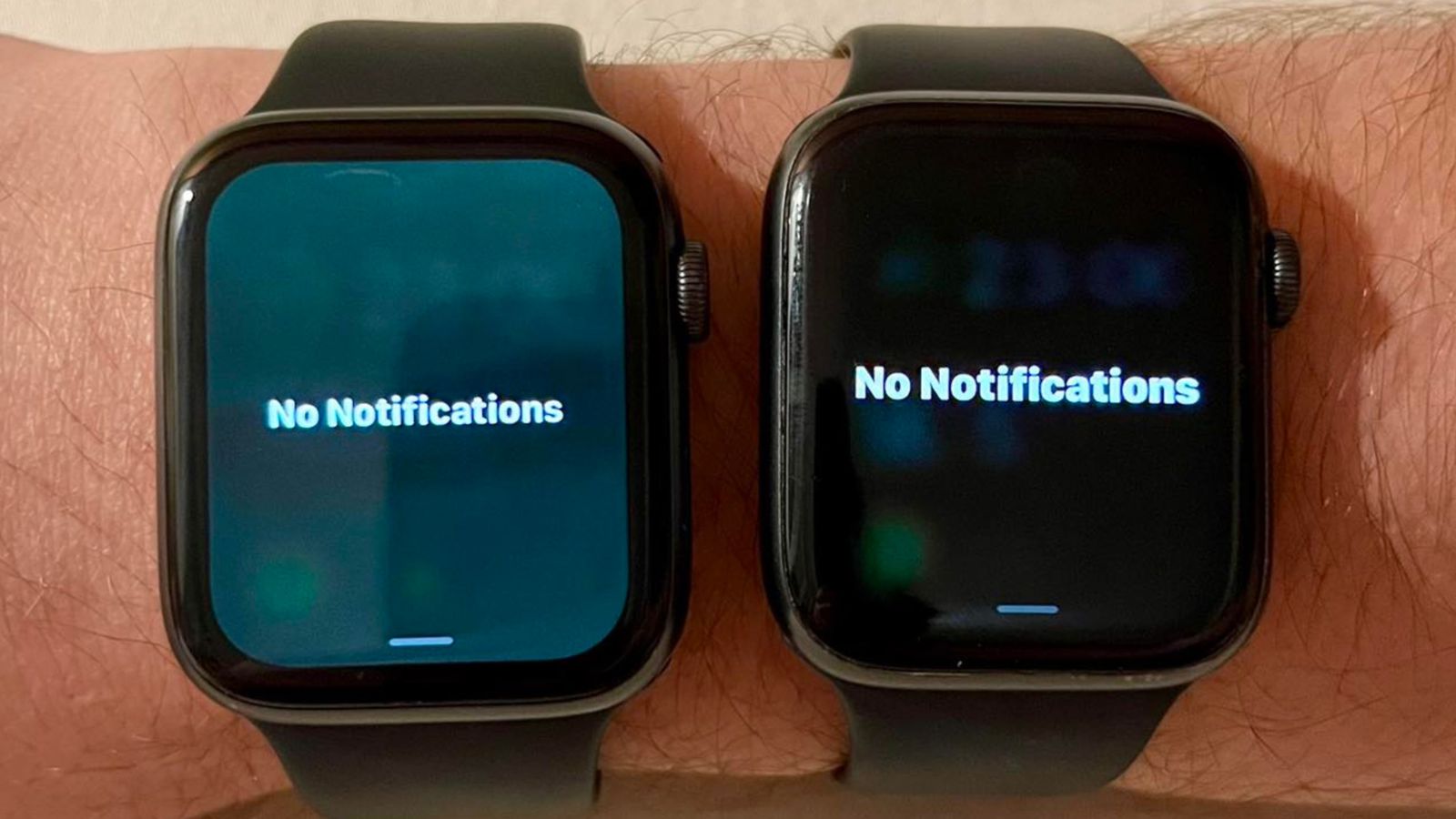 Einige Apple Watches sind nach dem Update auf watchOS 9.5 "grün" geworden