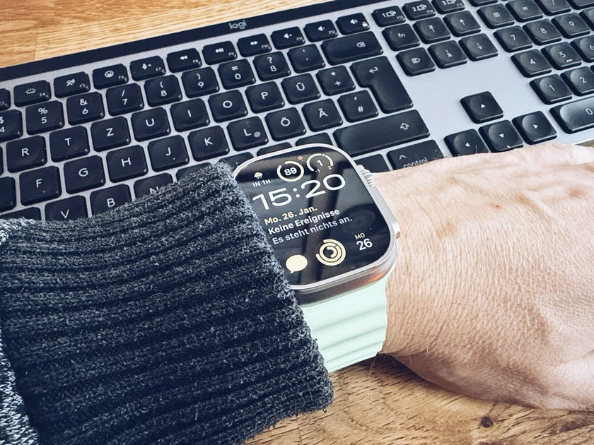 Apple Watch : des modèles sans écran et ronds envisagés pour séduire une nouvelle audience