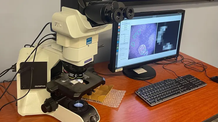 Google og Pentagon har utviklet et mikroskop basert på kunstig intelligens for kreftdiagnose.-2