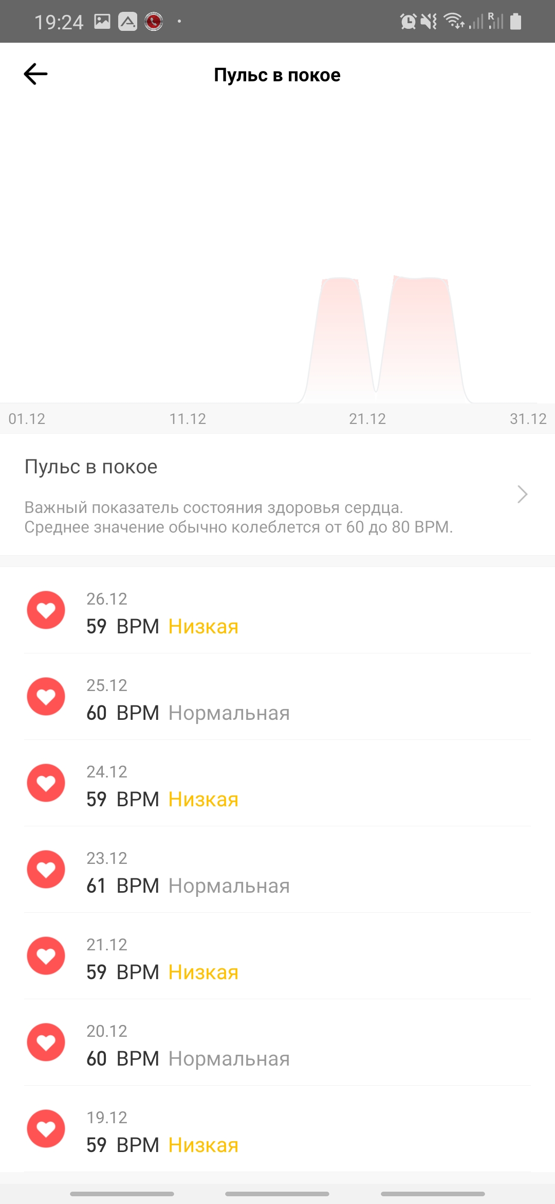 Огляд Amazfit GTS: Apple Watch для бідних?-63