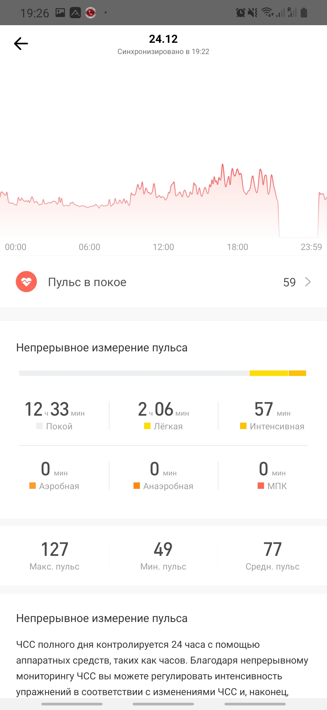 Огляд Amazfit GTS: Apple Watch для бідних?-64