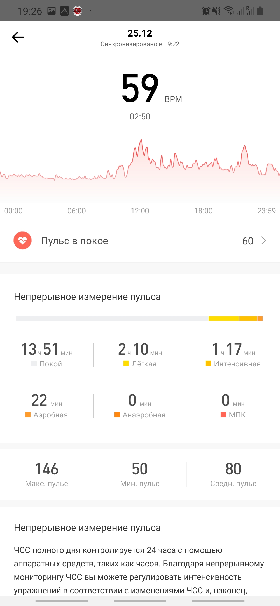 Огляд Amazfit GTS: Apple Watch для бідних?-65
