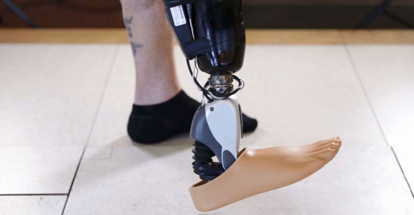 Компания Ossur создала управляемый мыслью протез