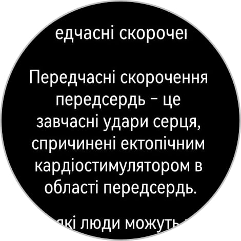 Переможець паніки: огляд смартгодинника Huawei Watch GT 6 Pro-176