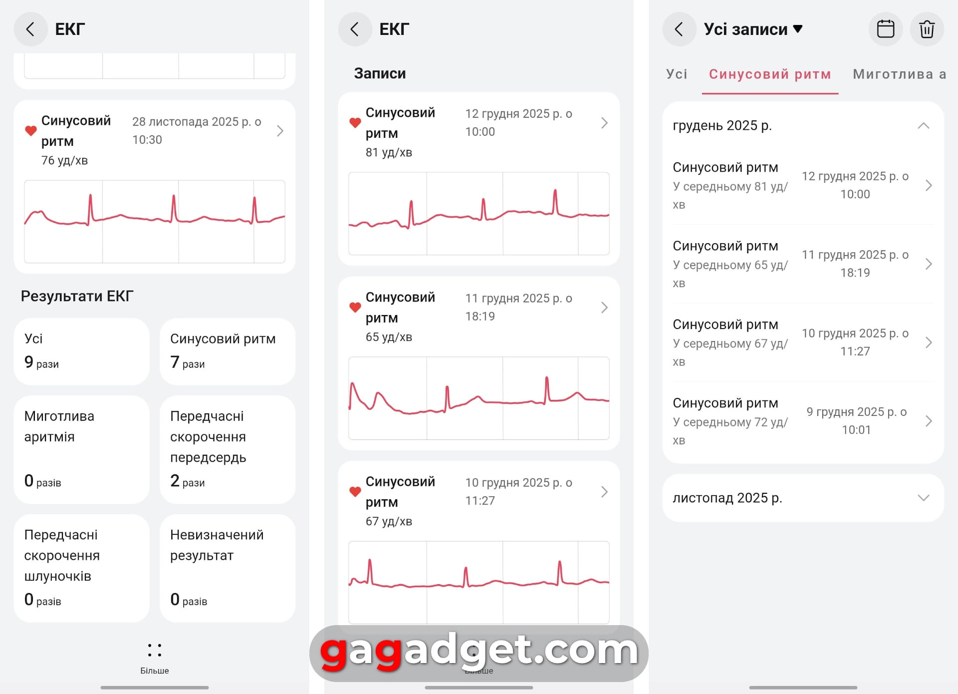 Переможець паніки: огляд смартгодинника Huawei Watch GT 6 Pro-27